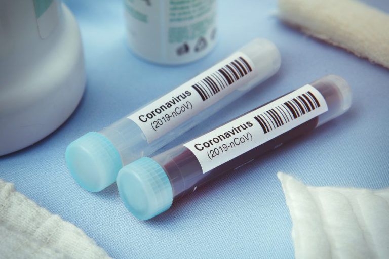 Test kit novel coronavirus (COVID19)