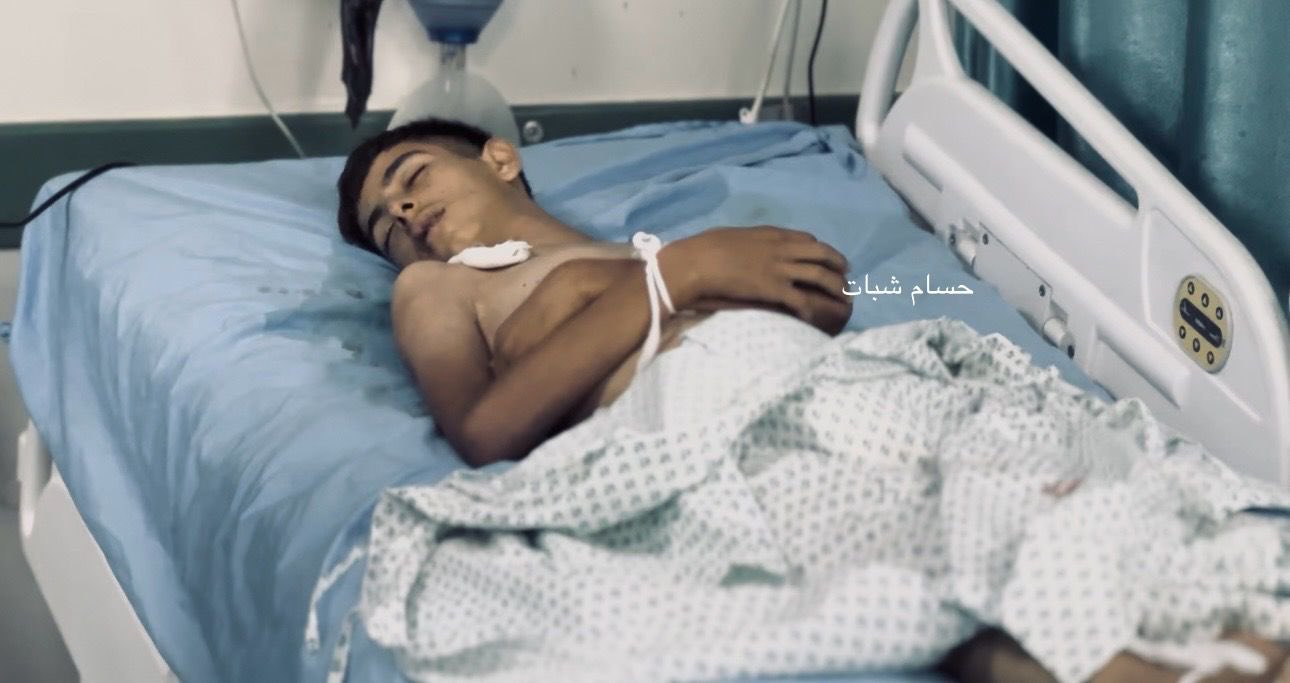 Un niño palestino de 17 años, Mohammed Assaf, del norte de la Franja de Gaza, muere como consecuencia de la hambruna y la crisis humanitaria.